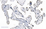 IHC staining of FFPE human placental tissue with SF1 antibody. HIER: boil tissue sections in pH8 EDTA for 20 min and allow to cool before testing.