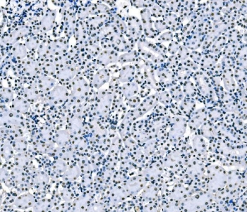 IHC staining of FFPE mouse kidney tissue with SF1 antibody. HIER: boil tissue sections in pH8 EDTA for 20 min and allow to cool before testing.