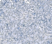 IHC staining of FFPE mouse kidney tissue with SF1 antibody. HIER: boil tissue sections in pH8 EDTA for 20 min and allow to cool before testing.