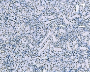 IHC staining of FFPE rat kidney tissue with SF1 antibody. HIER: boil tissue sections in pH8 EDTA for 20 min and allow to cool before testing.