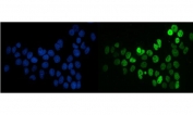 Immunofluorescent staining of FFPE human A431 cells with SF1 antibody (green) and DAPI nuclear stain (blue). HIER: steam section in pH6 citrate buffer for 20 min.