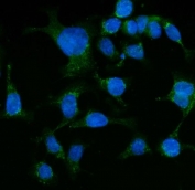 Immunofluorescent staining of FFPE human Caco-2 cells with HSPA9 antibody (green) and DAPI nuclear stain (blue). HIER: steam section in pH6 citrate buffer for 20 min.