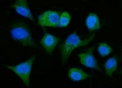 Immunofluorescent staining of FFPE human A549 cells with Aldehyde Dehydrogenase 1A1 antibody (green) and DAPI nuclear stain (blue). HIER: steam section in pH6 citrate buffer for 20 min.