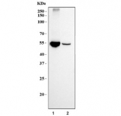 Western blot testing of human 1) A549 and 2) HepG2 cell lysate with Aldehyde Dehydrogenase 1A1 antibody. Predicted molecular weight ~55 kDa.