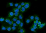 Immunofluorescent staining of FFPE human SiHa cells with Glutaminase antibody (green) and DAPI nuclear stain (blue). HIER: steam section in pH6 citrate buffer for 20 min.