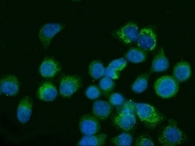 Immunofluorescent staining of FFPE human SiHa cells with GLS antibody (green) and DAPI nuclear stain (blue). HIER: steam section in pH6 citrate buffer for 20 min.