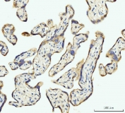 IHC staining of FFPE human placental tissue with Dihydroorotate dehydrogenase antibody. HIER: boil tissue sections in pH8 EDTA for 20 min and allow to cool before testing.