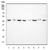 Western blot testing of 1) human HeLa, 2) human A431, 3) human HepG2, 4) human MCF7, 5) rat testis, 6) rat liver, 7) mouse testis and 8) mouse liver tissue lysate with Dihydroorotate dehydrogenase antibody. Predicted molecular weight ~43 kDa.