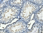 IHC staining of FFPE rat testis tissue with MCM6 antibody. HIER: boil tissue sections in pH8 EDTA for 20 min and allow to cool before testing.