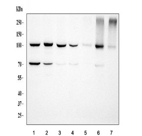 Western blot testing of 1) human HeLa, 2) human Jurkat, 3) human 293T, 4) human HepG2, 5) human U-2 OS, 6) rat RH35 and 6) mouse NIH 3T3 cell lysate with MCM6 antibody. Expected molecular weight: 92-105 kDa.