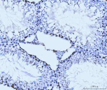IHC staining of FFPE rat testis tissue with MCM6 antibody. HIER: boil tissue sections in pH8 EDTA for 20 min and allow to cool before testing.