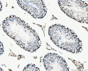 IHC staining of FFPE mouse testis tissue with MCM6 antibody. HIER: boil tissue sections in pH8 EDTA for 20 min and allow to cool before testing.