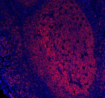 Immunofluorescent staining of FFPE human tonsil tissue with MS4A1 antibody (red) and DAPI nuclear stain (blue). HIER: steam section in pH6 citrate buffer for 20 min.~
