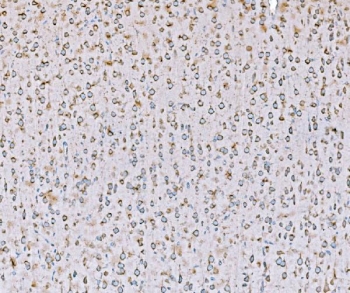 IHC staining of FFPE rat brain tissue with SND1 antibody. HIER: boil tissue sections in pH8 EDTA for 20 min and allow to cool before testing.