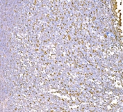 IHC staining of FFPE human tonsil tissue with SND1 antibody. HIER: boil tissue sections in pH8 EDTA for 20 min and allow to cool before testing.