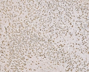 IHC staining of FFPE mouse brain tissue with SND1 antibody. HIER: boil tissue sections in pH8 EDTA for 20 min and allow to cool before testing.