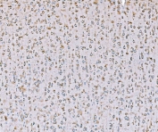 IHC staining of FFPE rat brain tissue with SND1 antibody. HIER: boil tissue sections in pH8 EDTA for 20 min and allow to cool before testing.