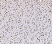IHC staining of FFPE rat brain tissue with SND1 antibody. HIER: boil tissue sections in pH8 EDTA for 20 min and allow to cool before testing.