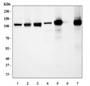 Western blot testing of 1) human HeLa, 2) human Raji, 3) human U-87 MG, 4) rat stomach, 5) rat pancreas, 6) mouse stomach and 7) mouse pancreas tissue with SND1 antibody. Predicted molecular weight ~102 kDa.