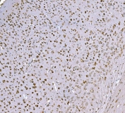 IHC staining of FFPE mouse brain tissue with TDRD11 antibody. HIER: boil tissue sections in pH8 EDTA for 20 min and allow to cool before testing.