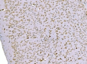 IHC staining of FFPE mouse brain tissue with TDRD11 antibody. HIER: boil tissue sections in pH8 EDTA for 20 min and allow to cool before testing.