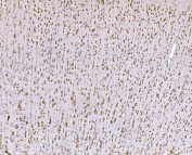 IHC staining of FFPE rat brain tissue with TDRD11 antibody. HIER: boil tissue sections in pH8 EDTA for 20 min and allow to cool before testing.