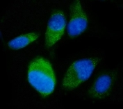 Immunofluorescent staining of FFPE human PC-3 cells with TDRD11 antibody (green) and DAPI nuclear stain (blue). HIER: steam section in pH6 citrate buffer for 20 min.