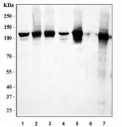 Western blot testing of 1) human HeLa, 2) human Raji, 3) human U-87 MG, 4) rat stomach, 5) rat pancreas, 6) mouse stomach and 7) mouse pancreas tissue with TDRD11 antibody. Predicted molecular weight ~102 kDa.