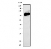 Western blot testing of human HepG2 cell lysate with Prothrombin antibody. Predicted molecular weight ~70 kDa, but may be observed at higher molecular weights due to glycosylation.