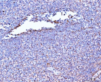 IHC staining of FFPE human spleen tissue with Filamin B antibody. HIER: boil tissue sections in pH8 EDTA for 20 min and allow to cool before testing.