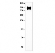 Western blot testing of 1) human A549 cell lysate with Filamin B antibody. Predicted molecular weight ~278 kDa.