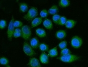 Immunofluorescent staining of FFPE human SiHa cells with ACSL4 antibody (green) and DAPI nuclear stain (blue). HIER: steam section in pH6 citrate buffer for 20 min.