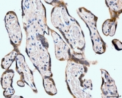 IHC staining of FFPE human placental tissue with Neurofibromin antibody. HIER: boil tissue sections in pH8 EDTA for 20 min and allow to cool before testing.