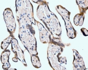 IHC staining of FFPE human placental tissue with Neurofibromin antibody. HIER: boil tissue sections in pH8 EDTA for 20 min and allow to cool before testing.
