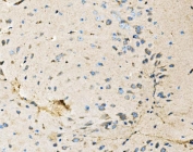 IHC staining of FFPE mouse brain tissue with Neurofibromin antibody. HIER: boil tissue sections in pH8 EDTA for 20 min and allow to cool before testing.