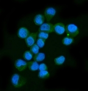Immunofluorescent staining of FFPE human T-47D cells with NF1 antibody (green) and DAPI nuclear stain (blue). HIER: steam section in pH6 citrate buffer for 20 min.