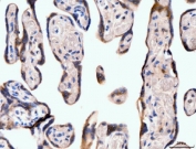 IHC staining of FFPE human placental tissue with NF1 antibody. HIER: boil tissue sections in pH8 EDTA for 20 min and allow to cool before testing.