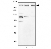 Western blot testing of 1) human HeLa, 2) rat brain and 3) mouse brain tissue lysate with NF1 antibody. Predicted molecular weight ~319 kDa.