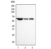Western blot testing of human 1) HeLa, 2) Jurkat and 3) SH-SY5Y cell lysate with Pyruvate Kinase antibody. Predicted molecular weight ~58 kDa.