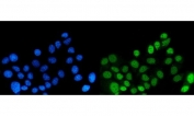 Immunofluorescent staining of FFPE human MCF7 cells with Dynein light chain 1 antibody (green) and DAPI nuclear stain (blue). HIER: steam section in pH6 citrate buffer for 20 min.