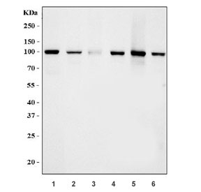 Western blot testing of 1) human HL60, 2) human Daudi, 3) human SW620, 4) rat brain, 5) mouse lung and 6) mouse brain tissue lysate with RLIP1 antibody. Predicted molecular weight ~76 kDa, observed molecular weight: 90-95 kDa.