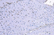 IHC staining of FFPE mouse brain tissue with RLIP1 antibody. HIER: boil tissue sections in pH8 EDTA for 20 min and allow to cool before testing.
