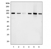 Western blot testing of 1) human HL60, 2) human Daudi, 3) human SW620, 4) rat brain, 5) mouse lung and 6) mouse brain tissue lysate with RLIP1 antibody. Predicted molecular weight ~76 kDa, observed molecular weight: 90-95 kDa.