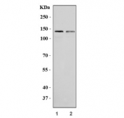 Western blot testing of human 1) HepG2 and 2) Caco-2 cell lysate with ABCB1 antibody. Expected molecular weight: 141-180 kDa depending on glycosylation level.