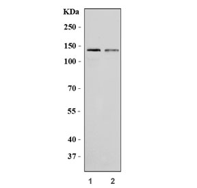 Western blot testing of human 1) HepG2 and 2) Caco-2 cell lysate with ABCB1 antibody. Expected molecular weight: 141-180 kDa depending on glycosylation level.