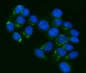 Immunofluorescent staining of FFPE human MCF7 cells with ABCB1 antibody (green) and DAPI nuclear stain (blue). HIER: steam section in pH6 citrate buffer for 20 min.