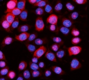Immunofluorescent staining of FFPE human Caco-2 cells with Aurora A antibody (red) and DAPI nuclear stain (blue). HIER: steam section in pH6 citrate buffer for 20 min.