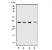 Western blot testing of human 1) HeLa, 2) Caco-2, 3) HepG2 and 4) SiHa cell lysate with Aurora A antibody. Predicted molecular weight ~45 kDa.