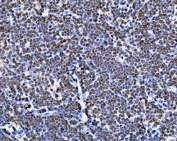 IHC staining of FFPE rat thymus tissue with BUB1 antibody. HIER: boil tissue sections in pH8 EDTA for 20 min and allow to cool before testing.