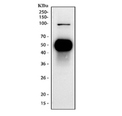 Western blot testing of human Jurkat cell lysate with CD2 antibody. Expected molecular weight ~47 kDa.